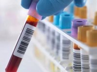 《体外诊断试剂注册与备案管理办法》2021年修订版