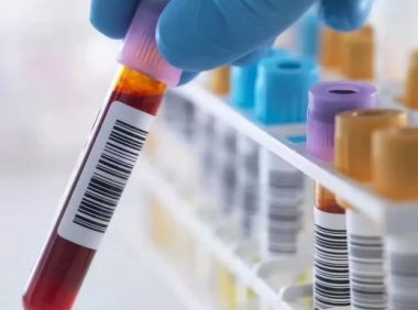 《体外诊断试剂注册与备案管理办法》2021年修订版